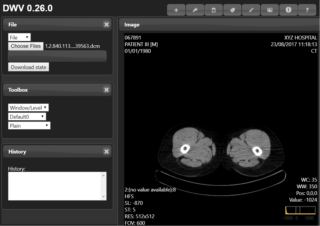 DicomWebViewer - Created by PostDICOM